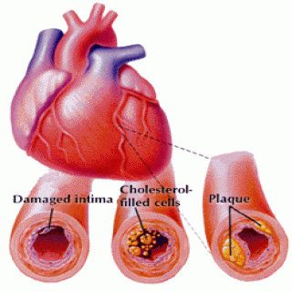 Đông trùng hạ thảo làm giảm cholesterol trong máu